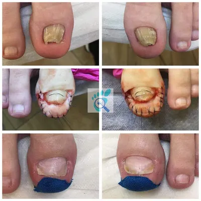 Gabinety Podologiczne ,,Boskie Stopy" Beata Lewicka